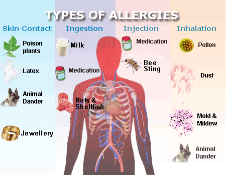 "Decoding Allergies: What You Need to Know about Reactions" could be: "Allergies and Reactions."
