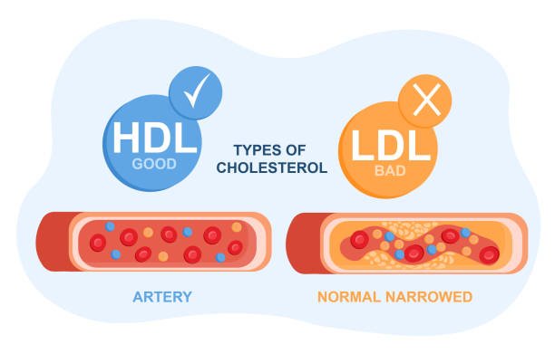 Good Cholesterol, Great Choices: Your Guide to Natural Sources"